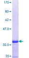 SLC25A23 Protein - 12.5% SDS-PAGE Stained with Coomassie Blue.
