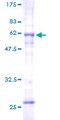 SLC25A3 Protein - 12.5% SDS-PAGE of human SLC25A3 stained with Coomassie Blue
