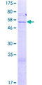 SLC25A31 Protein - 12.5% SDS-PAGE of human SLC25A31 stained with Coomassie Blue