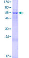 SLC25A39 Protein - 12.5% SDS-PAGE of human SLC25A39 stained with Coomassie Blue