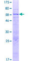 SLC25A42 Protein - 12.5% SDS-PAGE of human SLC25A42 stained with Coomassie Blue