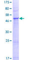 SLC35A4 Protein - 12.5% SDS-PAGE of human SLC35A4 stained with Coomassie Blue