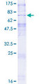 SLC35B1 / UGTREL1 Protein - 12.5% SDS-PAGE of human SLC35B1 stained with Coomassie Blue