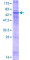 SLC35B2 Protein - 12.5% SDS-PAGE of human SLC35B2 stained with Coomassie Blue