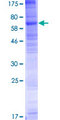 SLC35F1 Protein - 12.5% SDS-PAGE of human SLC35F1 stained with Coomassie Blue