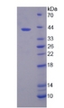 SLC39A6 / LIV-1 Protein - Recombinant  Solute Carrier Family 39, Member 6 By SDS-PAGE