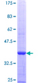 SLC4A1 / Band 3 / AE1 Protein - 12.5% SDS-PAGE Stained with Coomassie Blue.