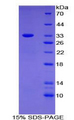 SLC4A1 / Band 3 / AE1 Protein - Recombinant Anion Exchange Protein 1 By SDS-PAGE
