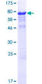 SLC7A6OS Protein - 12.5% SDS-PAGE of human SLC7A6OS stained with Coomassie Blue