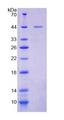 SLC9A3R2 / SIP1 Protein - Recombinant Tyrosine Kinase Activator Protein 1 By SDS-PAGE