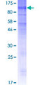 SLCO4C1 Protein - 12.5% SDS-PAGE of human SLCO4C1 stained with Coomassie Blue
