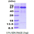 SMAD2 Protein