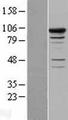 SMEK1 Protein - Western validation with an anti-DDK antibody * L: Control HEK293 lysate R: Over-expression lysate