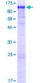 SMEK1 Protein - 12.5% SDS-PAGE of human SMEK1 stained with Coomassie Blue