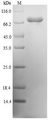 SMIF / DCP1A Protein - (Tris-Glycine gel) Discontinuous SDS-PAGE (reduced) with 5% enrichment gel and 15% separation gel.