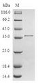 SMPX Protein - (Tris-Glycine gel) Discontinuous SDS-PAGE (reduced) with 5% enrichment gel and 15% separation gel.