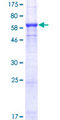 SMYD3 Protein - 12.5% SDS-PAGE of human SMYD3 stained with Coomassie Blue