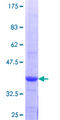 SMYD3 Protein - 12.5% SDS-PAGE Stained with Coomassie Blue.