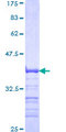 SNAP45 / SNAPC2 Protein - 12.5% SDS-PAGE Stained with Coomassie Blue.