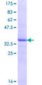 SNAPC3 Protein - 12.5% SDS-PAGE Stained with Coomassie Blue.