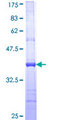 SNF8 / EAP30 Protein - 12.5% SDS-PAGE Stained with Coomassie Blue.