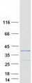 SNRNP35 Protein - Purified recombinant protein SNRNP35 was analyzed by SDS-PAGE gel and Coomassie Blue Staining