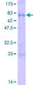 SNRNP48 Protein - 12.5% SDS-PAGE of human C6orf151 stained with Coomassie Blue