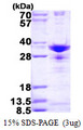 SNRPA1 Protein