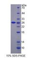 SNX17 Protein - Recombinant Sorting Nexin 17 By SDS-PAGE