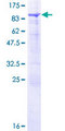 SNX33 Protein - 12.5% SDS-PAGE of human SH3PX3 stained with Coomassie Blue