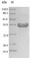 SOCS2 Protein - (Tris-Glycine gel) Discontinuous SDS-PAGE (reduced) with 5% enrichment gel and 15% separation gel.