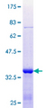 SP2 Protein - 12.5% SDS-PAGE Stained with Coomassie Blue.