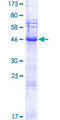 SPACA3 Protein - 12.5% SDS-PAGE of human SPACA3 stained with Coomassie Blue