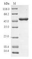 SPAG16 Protein - (Tris-Glycine gel) Discontinuous SDS-PAGE (reduced) with 5% enrichment gel and 15% separation gel.