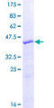 SPANXB2 Protein - 12.5% SDS-PAGE of human SPANXB1 stained with Coomassie Blue