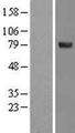 SPATA20 Protein - Western validation with an anti-DDK antibody * L: Control HEK293 lysate R: Over-expression lysate