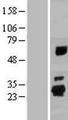 SPATA24 Protein - Western validation with an anti-DDK antibody * L: Control HEK293 lysate R: Over-expression lysate