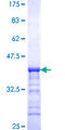 SPATA9 Protein - 12.5% SDS-PAGE Stained with Coomassie Blue.