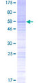 SPDYE2 Protein - 12.5% SDS-PAGE of human MGC119295 stained with Coomassie Blue