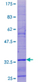 SPHAR Protein - 12.5% SDS-PAGE of human SPHAR stained with Coomassie Blue