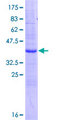 SPINLW1 / EPPIN Protein - 12.5% SDS-PAGE of human SPINLW1 stained with Coomassie Blue
