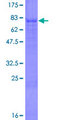 SPOCK3 Protein - 12.5% SDS-PAGE of human SPOCK3 stained with Coomassie Blue