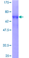 SPSB3 Protein - 12.5% SDS-PAGE of human SPSB3 stained with Coomassie Blue