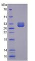 SPTBN4 Protein - Recombinant Spectrin Beta, Non Erythrocytic 4 By SDS-PAGE