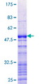 SREK1IP1 Protein - 12.5% SDS-PAGE of human P18SRP stained with Coomassie Blue