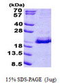 SRP19 Protein