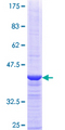 SRP68 Protein - 12.5% SDS-PAGE Stained with Coomassie Blue.