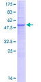 SRPRB Protein - 12.5% SDS-PAGE of human SRPRB stained with Coomassie Blue