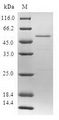 SSX5 Protein - (Tris-Glycine gel) Discontinuous SDS-PAGE (reduced) with 5% enrichment gel and 15% separation gel.