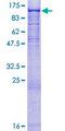 ST14 / Matriptase Protein - 12.5% SDS-PAGE of human ST14 stained with Coomassie Blue